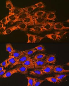 Immunofluorescence analysis of C6 cells using Anti-UQCRFS1/RISP Antibody [ARC1612] (A305931) at a dilution of 1:100 (40X lens). DAPI was used to stain the cell nuclei (blue)