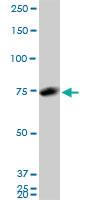 Anti-HNRNPM Mouse Monoclonal Antibody [clone: 3F7]