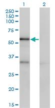 Anti-SERPINA10 Mouse Monoclonal Antibody [clone: 1E11]