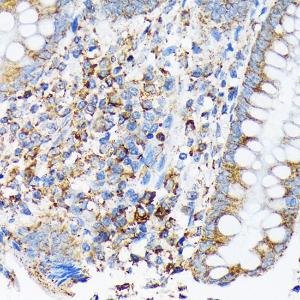 Immunohistochemistry analysis of paraffin-embedded human appendix tissue using Anti-Cdc25B Antibody [ARC1736] (A308797) at a dilution of 1:100 (40x lens). Perform microwave antigen retrieval with 10 mM Tris/EDTA buffer pH 9.0 before commencing with IHC staining protocol.