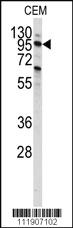 Anti-tcag7.1227 Rabbit Polyclonal Antibody