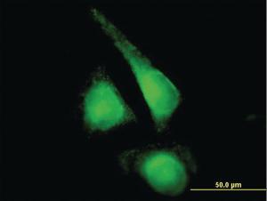 Anti-CYP2E1 Mouse Polyclonal Antibody