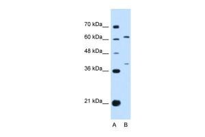 Anti-IFNLR1 Rabbit Polyclonal Antibody