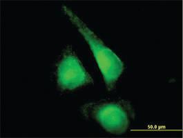 Anti-CYP2E1 Mouse Polyclonal Antibody