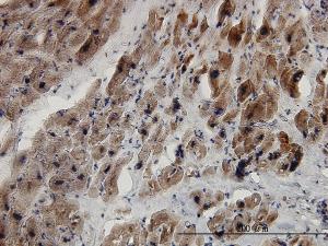 Anti-SMAD2 Mouse Monoclonal Antibody [clone: 3G6]