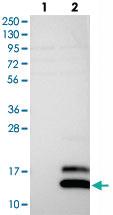 Anti-SCGB2A1 Rabbit Polyclonal Antibody