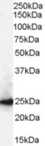 EB06958 (0.3 µg/ml) staining of A431 lysate (35 µg protein in RIPA buffer). Primary incubation was 1 hour. Detected by chemiluminescence.