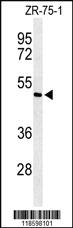 Anti-MYOM1 Rabbit Polyclonal Antibody