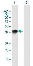 Anti-HMX1 Mouse Polyclonal Antibody