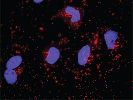 Anti-SKP1 + CTNNB1 Antibody Pair