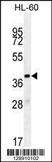 Anti-OR10J5 Rabbit Polyclonal Antibody (AP (Alkaline Phosphatase))