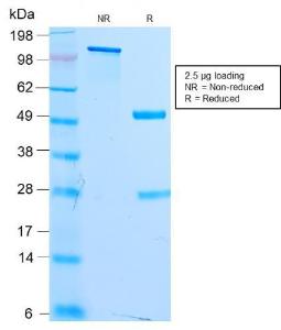 SDS-PAGE analysis of Anti-MiTF Antibody [MITF/2987R] under non-reduced and reduced conditions; showing intact IgG and intact heavy and light chains, respectively SDS-PAGE analysis confirms the integrity and purity of the antibody