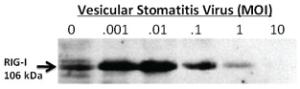 Anti-DDX58 Rabbit Polyclonal Antibody