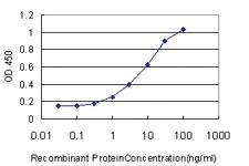 Anti-SOX4 Mouse Monoclonal Antibody [clone: 2C5]