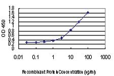 Anti-RAD18 Mouse Monoclonal Antibody [clone: 3H7]