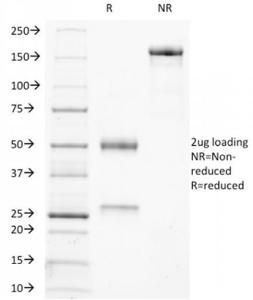 SDS-PAGE analysis of Anti-Ku70 Antibody [KU729] under non-reduced and reduced conditions; showing intact IgG and intact heavy and light chains, respectively SDS-PAGE analysis confirms the integrity and purity of the antibody