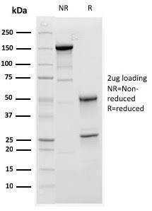 SDS-PAGE analysis of Anti-C1QA Antibody [C1QA/2952] under non-reduced and reduced conditions; showing intact IgG and intact heavy and light chains, respectively. SDS-PAGE analysis confirms the integrity and purity of the antibody