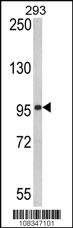 Anti-DDX58 Rabbit Polyclonal Antibody