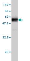 Anti-HS1BP3 Mouse Monoclonal Antibody [clone: 1E2]