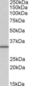 EB06970 (1 µg/ml) staining of Daudi lysate (35 µg protein in RIPA buffer). Primary incubation was 1 hour. Detected by chemiluminescence.