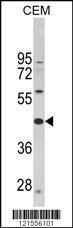 Anti-PTAR1 Rabbit Polyclonal Antibody (Biotin)