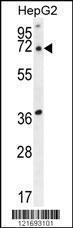 Anti-ACOT11 Rabbit Polyclonal Antibody (PE (Phycoerythrin))