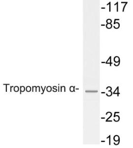 Anti-Tropomyosin alpha antibody