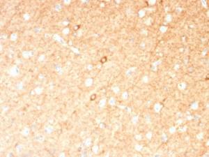 Immunohistochemical analysis of formalin-fixed, paraffin-embedded human brain using Anti-GAD67 Antibody [GAD1/2391]