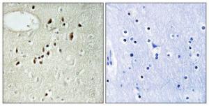 Immunohistochemical analysis of paraffin-embedded human brain tissue using Anti-EMX2 Antibody. The right hand panel represents a negative control, where the antibody was pre-incubated with the immunising peptide