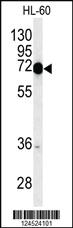 Anti-PTX3 Rabbit Polyclonal Antibody