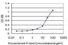 Anti-SERPINA10 Mouse Monoclonal Antibody [clone: 1E11]