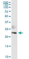 Anti-ATF6 Polyclonal Antibody Pair