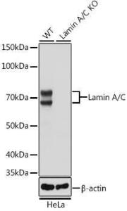 Western blot analysis of extracts from wild type (WT) and Lamin A/C knockout (KO) HeLa cells, using Anti-Lamin A Antibody [ARC5001-08] (A308800) at 1:50,000 dilution