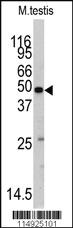 Anti-GTF2H1 Rabbit Polyclonal Antibody