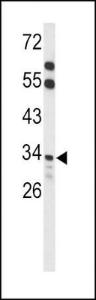 Anti-ACOT8 Rabbit Polyclonal Antibody (AP (Alkaline Phosphatase))