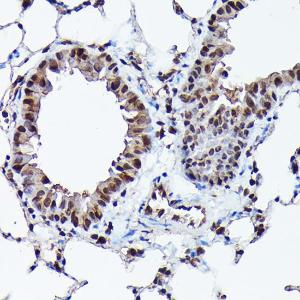 Immunohistochemistry analysis of paraffin-embedded mouse lung using Anti-Ubiquitin Antibody [ARC50024] (A307666) at a dilution of 1:100 (40X lens). Perform high pressure antigen retrieval with 10 mM citrate buffer pH 6.0 before commencing with IHC staining protocol