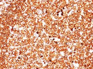 Antibody anti-CD79A SPM549 100 µg