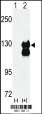 Anti-UPF1 Rabbit Polyclonal Antibody