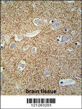 Anti-SNCB Rabbit Polyclonal Antibody (HRP (Horseradish Peroxidase))