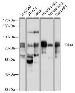 Western blot analysis of extracts of various cell lines, using Anti-GRK4 Antibody (A11299) at 1:1,000 dilution The secondary antibody was Goat Anti-Rabbit IgG H&L Antibody (HRP) at 1:10,000 dilution Lysates/proteins were present at 25 µg per lane