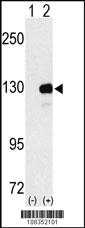 Anti-UPF1 Rabbit Polyclonal Antibody