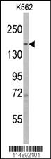 Anti-PHLPP1 Rabbit Polyclonal Antibody