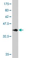 Anti-DSTYK Mouse Monoclonal Antibody [clone: 4F3]