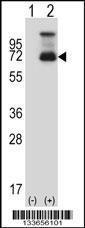 Anti-HSF1 Rabbit Polyclonal Antibody (AP (Alkaline Phosphatase))