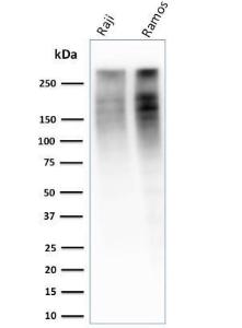 Western blot analysis of Raji and Ramos cell lysates using Anti-Ki67 Antibody [MKI67/2461]