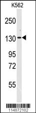 Anti-RNF20 Rabbit Polyclonal Antibody