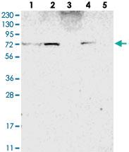 Anti-ZNF846 Rabbit Polyclonal Antibody