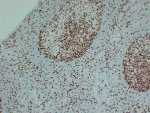 Immunohistochemical analysis of paraffin-embedded human Tonsil using Anti-MCM2 Antibody