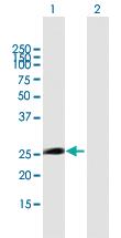 Anti-NMRK2 Mouse Polyclonal Antibody