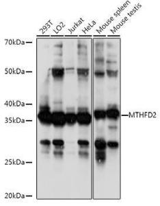 Western blot analysis of extracts of various cell lines, using Anti-MTHFD2 Antibody (A11302) at 1:1,000 dilution The secondary antibody was Goat Anti-Rabbit IgG H&L Antibody (HRP) at 1:10,000 dilution Lysates/proteins were present at 25 µg per lane